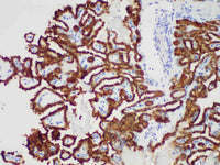 Galectin-3 Monoclonal Antibody Stored at -20°C