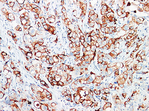 GCDFP-15 Monoclonal Antibody Stored at -20°C
