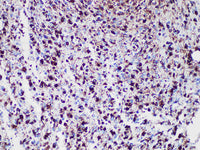 GFAP Monoclonal Antibody Stored at -20°C Host Rabbit