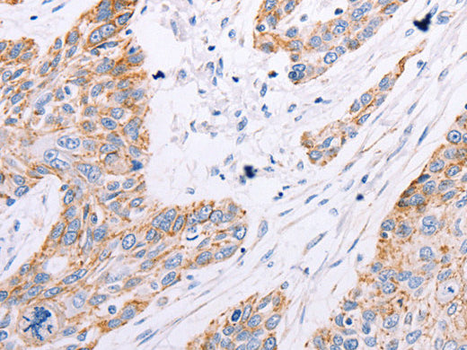 GFRA3 Polyclonal Antibody Store at -20°C, Biomarkers, Elabscience Biotechnology, MSE Supplies