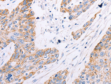 GFRA3 Polyclonal Antibody Store at -20°C, Biomarkers, Elabscience Biotechnology, MSE Supplies