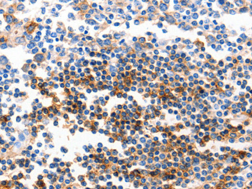 GJB6 Polyclonal Antibody Store at -20°C, Biomarkers, Elabscience Biotechnology, MSE Supplies