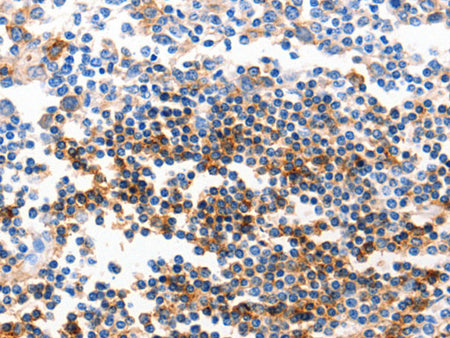 GJB6 Polyclonal Antibody Store at -20°C, Biomarkers, Elabscience Biotechnology, MSE Supplies
