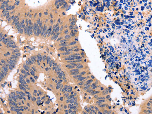 Glucocorticoid Receptor Polyclonal Antibody Store at -20°C, Biomarkers, Elabscience Biotechnology, MSE Supplies