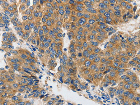 GluR2 Polyclonal Antibody Store at -20°C, Biomarkers, Elabscience Biotechnology, MSE Supplies