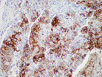 Glypican-3 Monoclonal Antibody Stored at -20°C