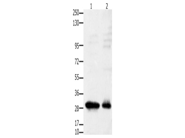 GNRHR Polyclonal Antibody Store at -20°C, Biomarkers, Elabscience Biotechnology, MSE Supplies