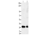 GNRHR Polyclonal Antibody Store at -20°C, Biomarkers, Elabscience Biotechnology, MSE Supplies