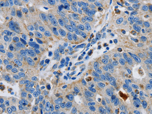 GRIA3 Polyclonal Antibody Store at -20°C, Biomarkers, Elabscience Biotechnology, MSE Supplies