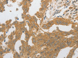 GRIN2C Polyclonal Antibody Store at -20°C, Biomarkers, Elabscience Biotechnology, MSE Supplies