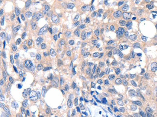 GRIN2D Polyclonal Antibody Store at -20°C, Biomarkers, Elabscience Biotechnology, MSE Supplies