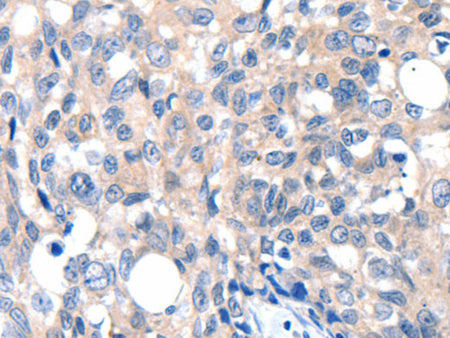 GRIN2D Polyclonal Antibody Store at -20°C, Biomarkers, Elabscience Biotechnology, MSE Supplies