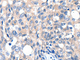 GRIN2D Polyclonal Antibody Store at -20°C, Biomarkers, Elabscience Biotechnology, MSE Supplies