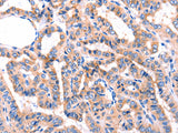 GRK2 Polyclonal Antibody Store at -20°C, Biomarkers, Elabscience Biotechnology, MSE Supplies