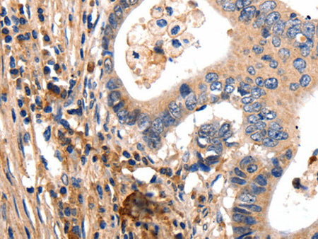 GSK3 Alpha Polyclonal Antibody Store at -20°C, Biomarkers, Elabscience Biotechnology, MSE Supplies