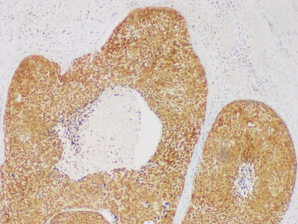 GST-P Monoclonal Antibody