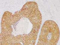 GST-P Monoclonal Antibody