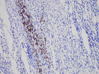 HbsAg Monoclonal Antibody