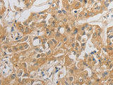 HCRTR2 Polyclonal Antibody Store at -20°C, Biomarkers, Elabscience Biotechnology, MSE Supplies