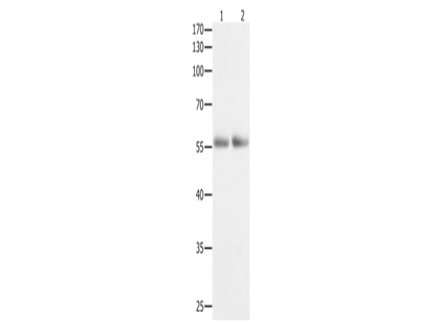 HDAC1 Polyclonal Antibody Store at -20°C, Biomarkers, Elabscience Biotechnology, MSE Supplies
