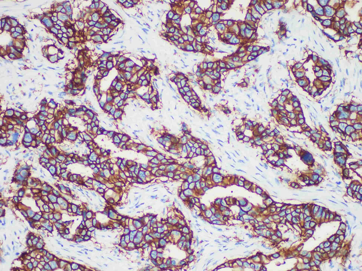 Her-2 Monoclonal Antibody stored at 2~8°C