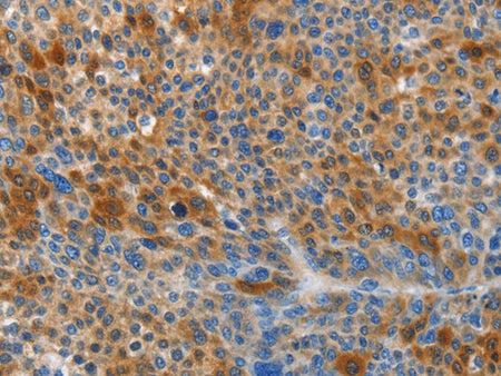 HTRA3 Polyclonal Antibody