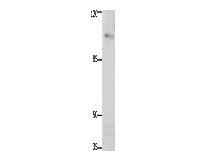 FAK Polyclonal Antibody Store at -20°C