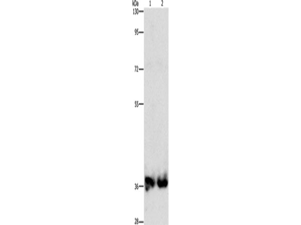 ASPA Polyclonal Antibody Store at -20°C