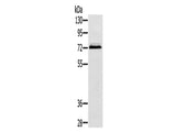 SSX2IP Polyclonal Antibody Store at -20°C