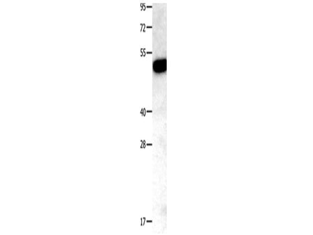 TNFRSF11B Polyclonal Antibody Store at -20°C