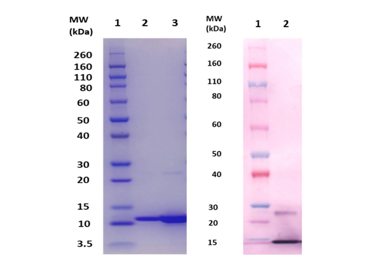 IBT Bioservices ESXB Protein (S. Aureus), Biomolecules and Materials, IBT Bioservices, MSE Supplies
