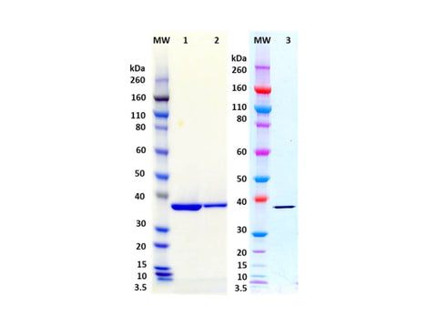 IBT Bioservices S. Aureus Recombinant Leukocidin-D (Tag Free), Biomolecules and Materials, IBT Bioservices, MSE Supplies