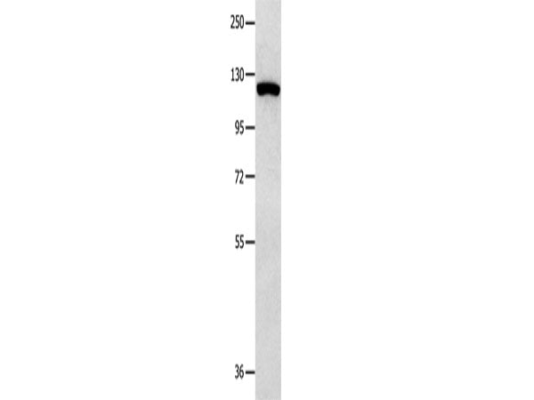 MVP Polyclonal Antibody Store at -20°C