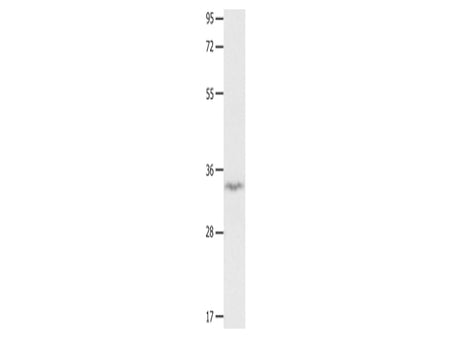 IGFBP7 Polyclonal Antibody Store at -20°C, Biomarkers, Elabscience Biotechnology, MSE Supplies