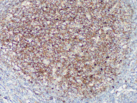 IgM Monoclonal Antibody Stored at -20°C