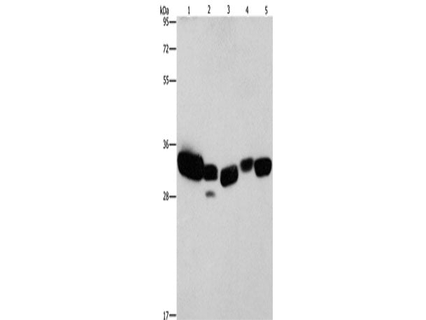 CBR1 Polyclonal Antibody Store at -20°C