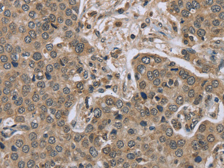 IL15RA Polyclonal Antibody Store at -20°C, Biomarkers, Elabscience Biotechnology, MSE Supplies