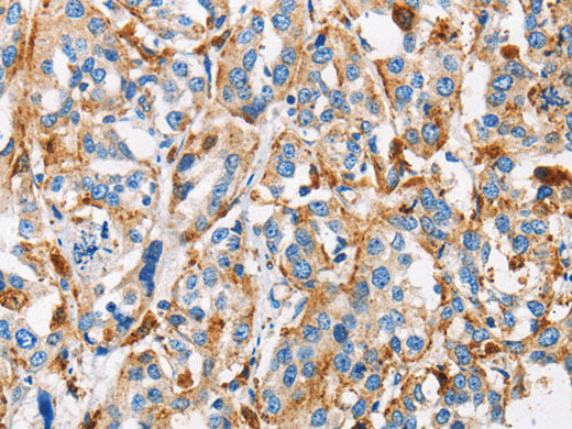 Cathepsin L Polyclonal Antibody Store at -20°C