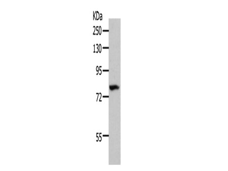 CD10 Polyclonal Antibody Store at -20°C