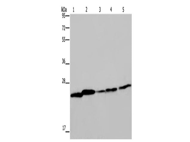 ARHGDIA Polyclonal Antibody Store at -20°C