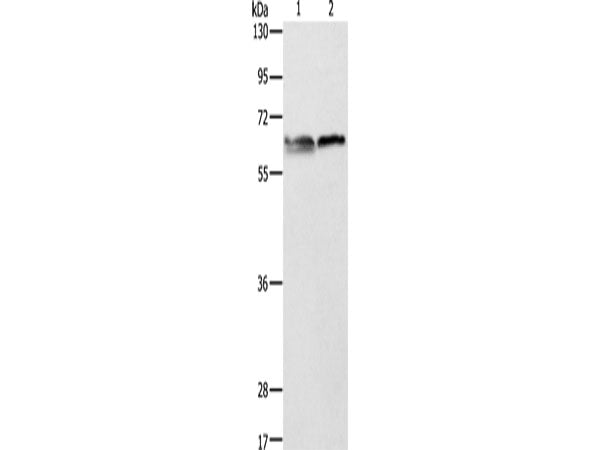 ALAS2 Polyclonal Antibody Store at -20°C