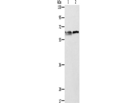 ALAS2 Polyclonal Antibody Store at -20°C