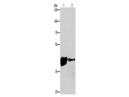 MAPK11 Polyclonal Antibody Store at -20°C