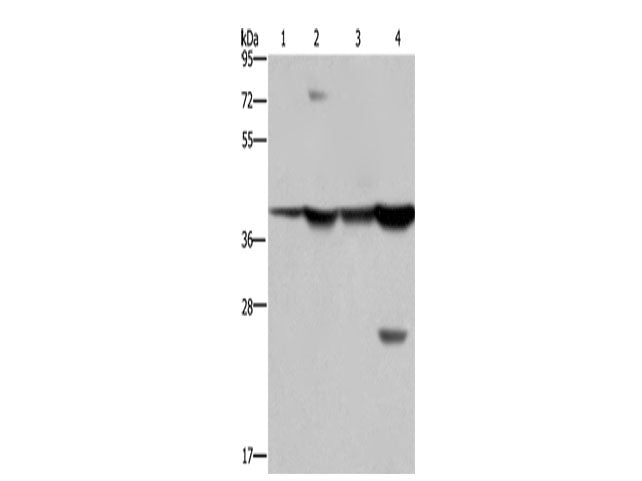 FBP1 Polyclonal Antibody Store at -20°C