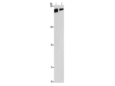 CLTC Polyclonal Antibody Store at -20°C