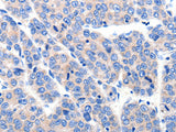KCNH8 Polyclonal Antibody Store at -20°C, Biomarkers, Elabscience Biotechnology, MSE Supplies