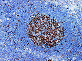 Ki-67 Monoclonal Antibody stored at 2~8°C