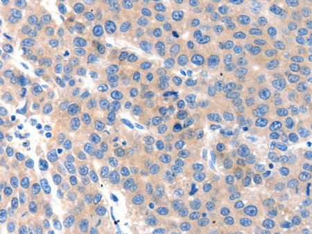 KLK2 Polyclonal Antibody Store at -20°C, Biomarkers, Elabscience Biotechnology, MSE Supplies
