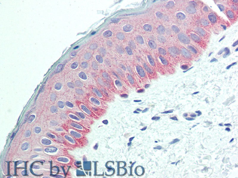 NECTIN4 Polyclonal Antibody Store at -20°C