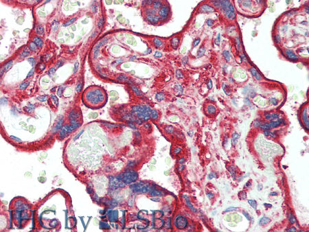 CLTC Polyclonal Antibody Store at -20°C